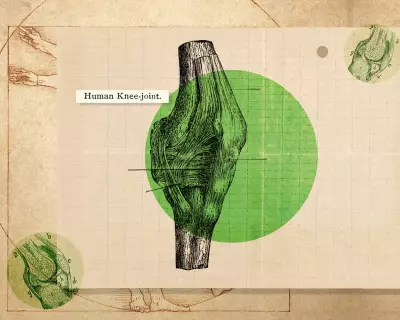 Knee Health: Expert Physio Advice to Avoid Injury & Surgery