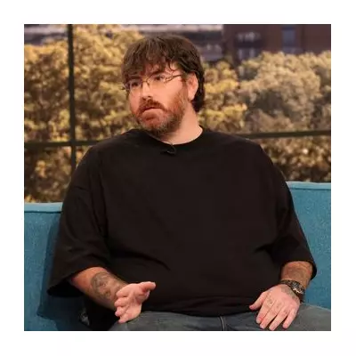 Man with Micropenis Aims for World Record, Reveals Impact on Life