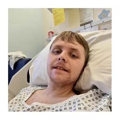 Youngest UK Dementia Patient's Death: Warning Over 'Unusual' Symptoms