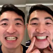 45-year-old man regains smile confidence with 42p-a-day teeth whitening fix