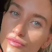 Emmerdale's Charley Webb Praises Celebrity-Loved Hydrogel Eye Patches for Under-Eye Rescue