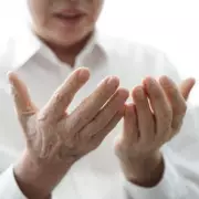 Fingernail Colour Changes Could Signal Serious Diseases - Expert Warning