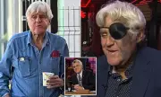 Jay Leno Spotted with Swollen Cheek and Bruised Finger in LA After String of Accidents