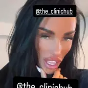 Katie Price unveils 'kissable' lips and plans BBL surgery after JJ Slater split