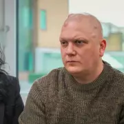 Man left speechless as huge cysts removed from scalp on The Bad Skin Clinic