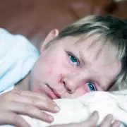 Measles Crisis: NHS Enforces Four-Day Rule as UK Loses Elimination Status