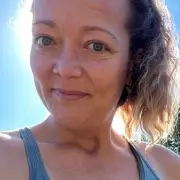 Mum, 42, chooses amputation after pet dog mauls leg 'hanging by a thread'