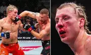 Paddy Pimblett Hospitalised After Bloody UFC 324 Loss to Justin Gaethje