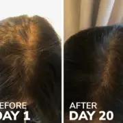 ‘People ask if I’ve had Botox’ after using 93p-a-day collagen shot