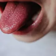 Pharmacist's Vital Alert for Omeprazole and Metformin Users on B12 Deficiency