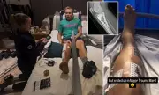 Sir Chris Hoy's Gruelling 12-Week Recovery from Horrific Bike Crash Revealed