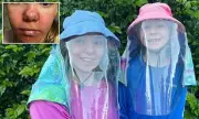 Sisters' Sunlight Battle: Rare XP Disorder Sparks £280k Garden Appeal