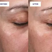 Skin Rocks Launches 'Borderline Illegal' Retinoid 3 Serum with Dramatic Wrinkle Reduction