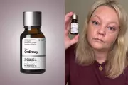 The Ordinary's 'Filler in a Bottle' Serum Tested: A Beauty Editor's Verdict After 30 Days