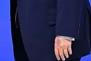 Trump's Bruised Hand at Davos Sparks White House Explanation