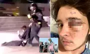 US Student 'Completely Blind' in One Eye After Anti-ICE Protest Clash in California