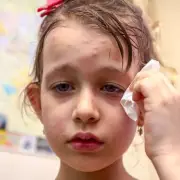 WHO Declares Measles 'Re-Established' in UK as Vaccination Rates Hit Decade Low