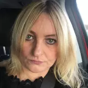 Woman loses fingers and toes after kidney stone leads to septic shock