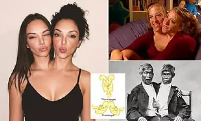 AI-Generated Conjoined Twins Spark Ethical Debate on Social Media