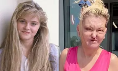 Danniella Westbrook's Facial Reconstruction Journey After Addiction Damage