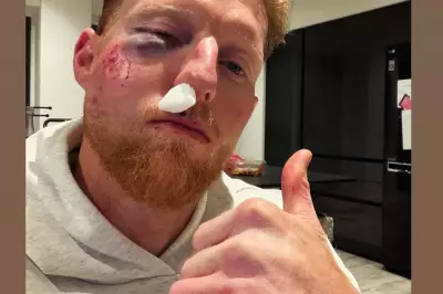 England Captain Ben Stokes Reveals Gruesome Facial Injury After Cricket Ball Strike