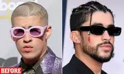 Bad Bunny's Dramatic Transformation: Experts Suggest Cosmetic Enhancements