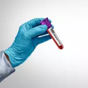 Chinese Scientists Develop Laser Blood Test for Early Cancer Detection