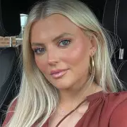 Coronation Street's Lucy Fallon Praises £19 Balm for Dermatitis Relief