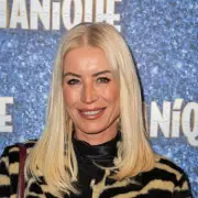 Denise Van Outen's Battle with Eczema: TV Star's Skin Flare-Ups and Self-Consciousness