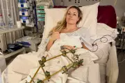 Lindsey Vonn Credits Doctor for Saving Leg from Amputation After Olympic Crash