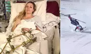 Lindsey Vonn Still Unable to Stand After Four Surgeries Following Olympic Leg Break