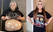Liverpool Woman's 15 Stone Weight Loss After NHS Gastric Bypass Surgery