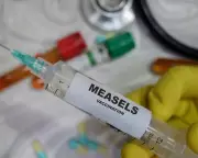 London Measles Outbreak: Over 60 Children Infected Amid Low Vaccination Rates