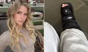 Lottie Moss Injured in Mystery Foot Incident Amid New Romance with Art Expert