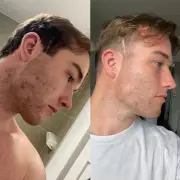 Man's Skin Transformed by Grandmother's Secret Formula, Now a Global Brand