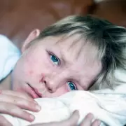 Measles Outbreak in North London Schools: Over 60 Cases Reported