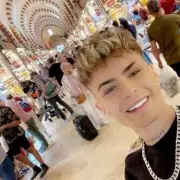 Model's £3k Turkey Teeth Nightmare: 'I Look Like a Shark in a Horror Movie'