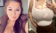 Mother Denied NHS Breast Reduction Despite Sepsis Risk from Bust Size