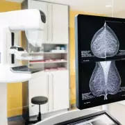 NHS Urges Women Aged 50-70 to Attend Vital Breast Cancer Screenings