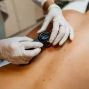 Scientists Identify Key Gene Driving Melanoma Spread and Immune Evasion