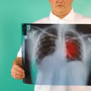 Simple 'Finger Test' at Home Could Reveal Early Lung Cancer Signs