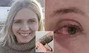 Tattoo Ink Linked to Vision Loss: Australian Study Reveals Alarming Eye Condition