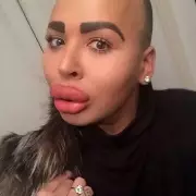 The Lip King's Tragic End: From Surgery Obsession to Manslaughter Arrests