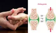 The Truth About Cracking Joints: From Harmless Pops to Warning Signs
