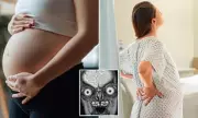 Viral Fetal MRI Images Spark Debate Over Safety and Necessity in Pregnancy