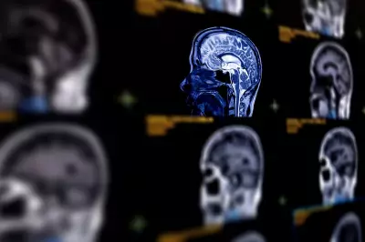 AI Achieves 93% Accuracy in Predicting Alzheimer's Disease Through Brain Scans