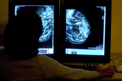 AI in Breast Cancer Screening Detects Hidden Heart Disease Risk
