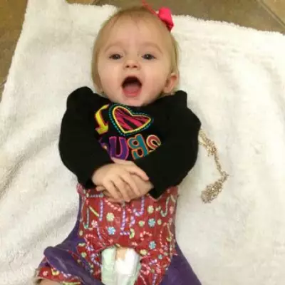 Baby's 148 Fractures Mistaken for Abuse Before Rare Bone Disease Diagnosis