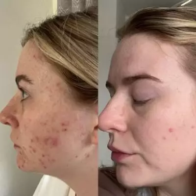 Dermatologist Reveals Silver Bullet Ingredient for Smooth, Clear Skin