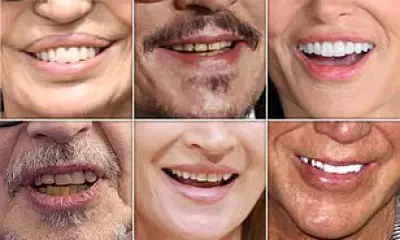 How Your Teeth Reveal Your True Age: Dentists Analyse Celebrity Smiles